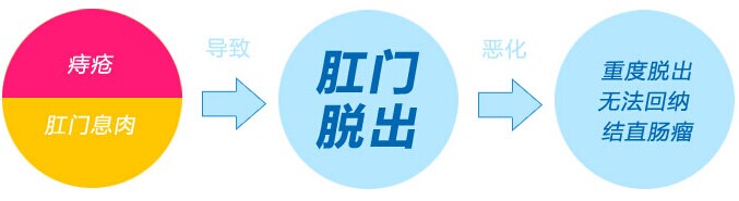 肛门脱出