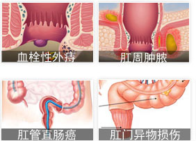 肛门疼痛病因