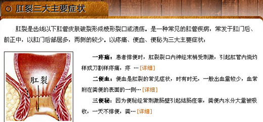 肛裂症状