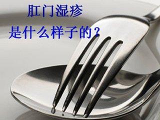 肛周湿疹症状