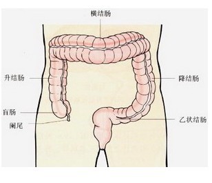 结肠炎护理