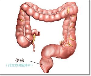 便秘预防